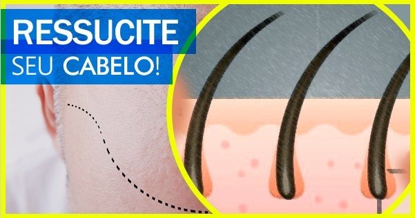 hair-loss-blocker-centro-natural